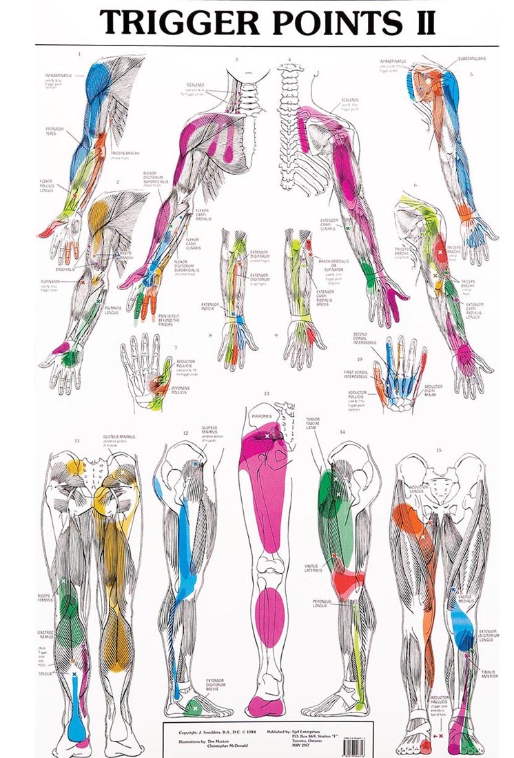 Janet Travell Trigger Point Chart